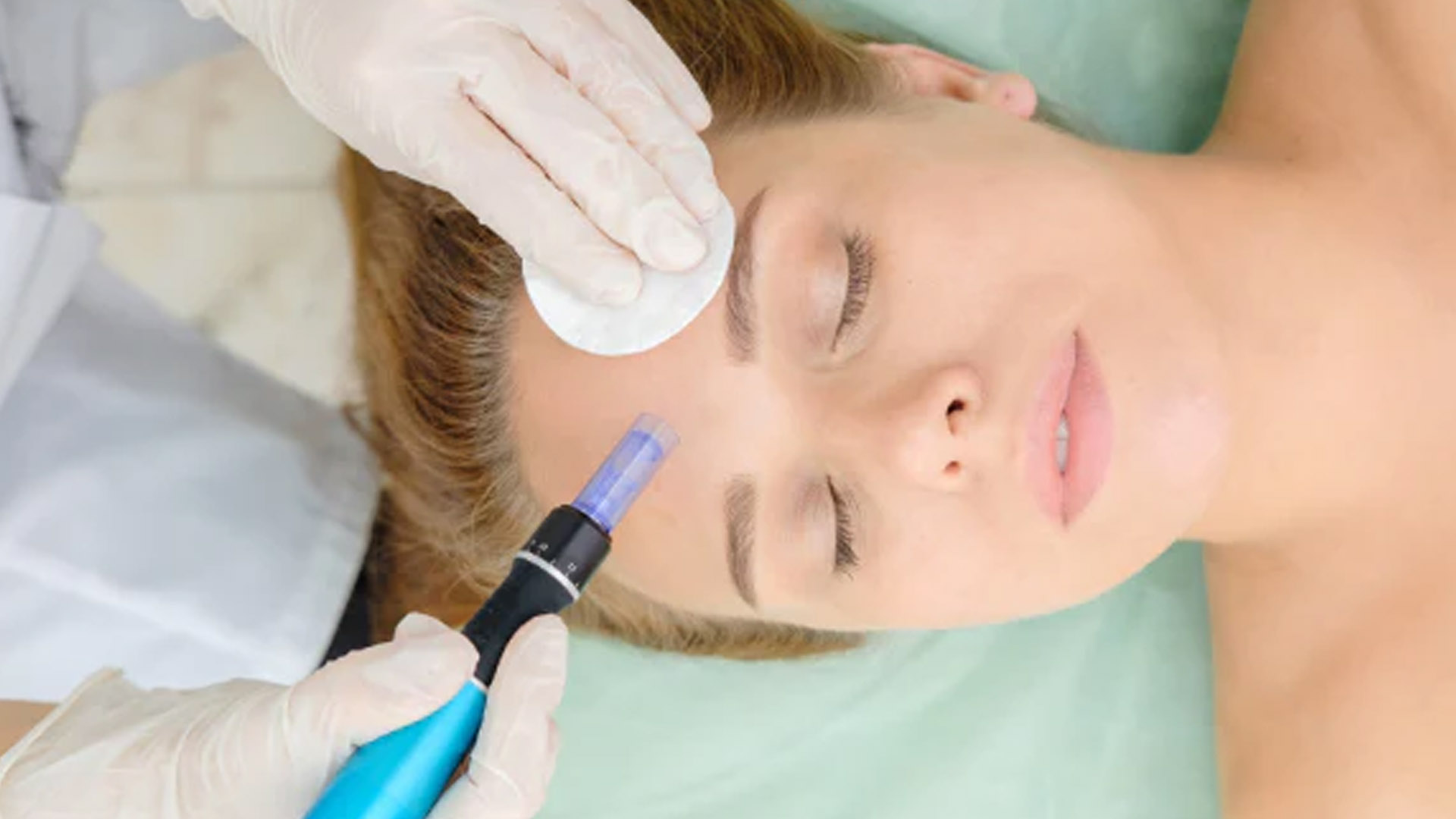 all about prp microneedling san diego neu look